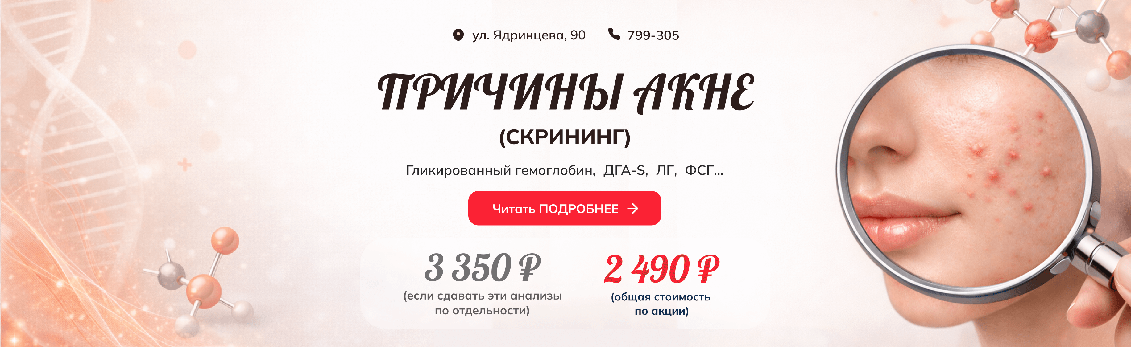 Иконка баннера ведущего на страницу https://arnika-irk.ru/stocks/stock/30